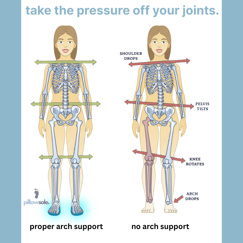 Professional - Grade Extra Support Insoles™ - Pillow Sole